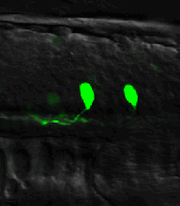 two nerve cells in bright green on a black background
