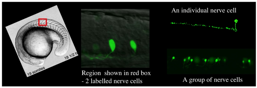 Composite of 3 photos showing nerve cells and groups of nerve cells.
